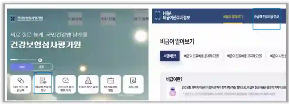 비급여 알아보기